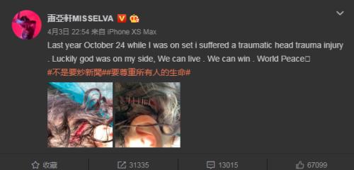 萧亚轩首次公开意外受伤照片，伤口触目惊心网友直呼心疼！