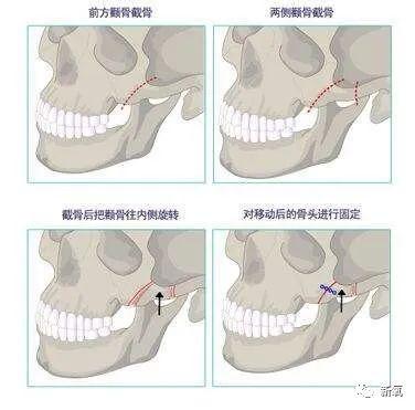 眯眯眼大饼脸的她到底是怎么打败周扬青成功上位的？