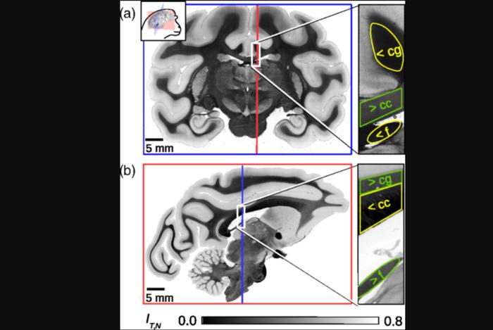终于实现：绘制大脑神经纤维路径交叉点，创建大脑真3D不难了！