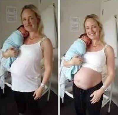 丹麦妈妈晒孕期、孕后肚子对比照，张张泪目，网友感慨：当妈不易
