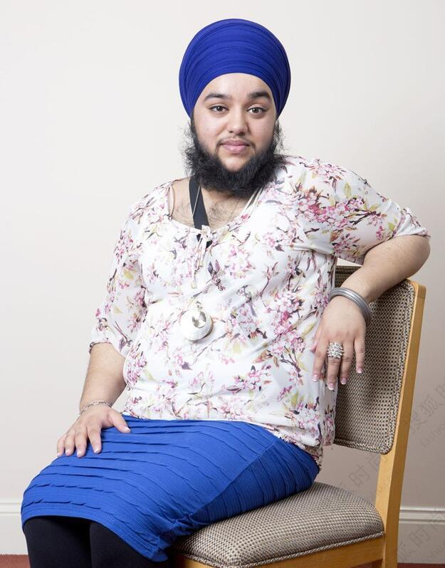 23岁女孩不仅长胡子,还有一巴掌宽护心毛,一句话感动众人!