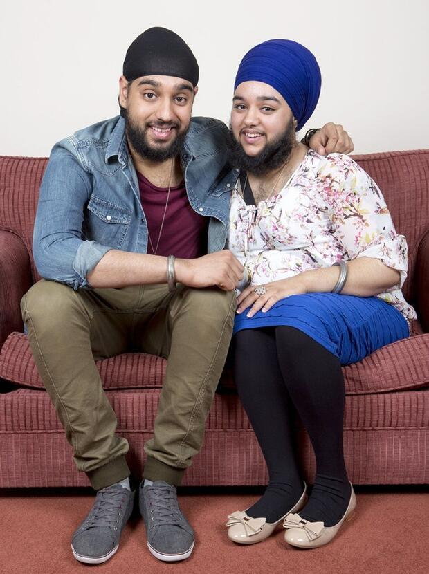 23岁女孩不仅长胡子,还有一巴掌宽护心毛,一句话感动众人!