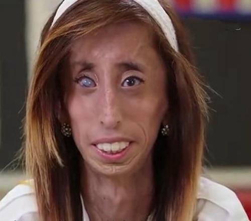 世界上最丑的女人,追求她的帅哥排长队,很多人因追不到而遗憾 世界上最丑的女人,追求她的帅哥排长队,很多人因追不到而遗憾