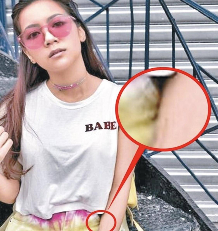 何雁诗婚前剖白郑俊弘过错,曾疑似因丑闻割脉自杀,直言做好自己