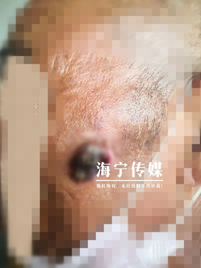 △图片已做模糊处理