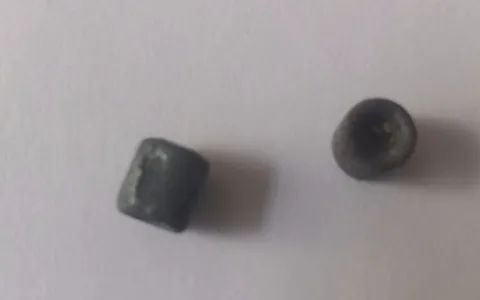  ▲李景湖体内取出的弹头。受访者供图