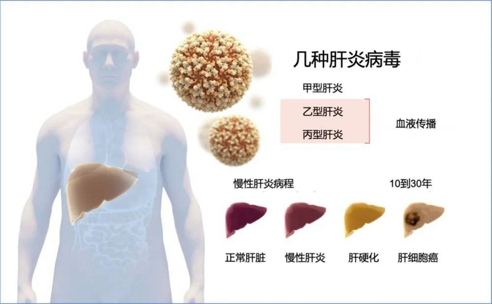 几种肝炎病毒（图片来源：诺贝尔奖官网）