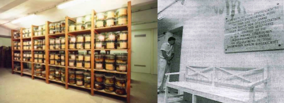 脑标本 图源：《 Am Spiegelgrund 》, Vermont University