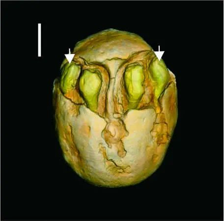 南酸枣化石微型CT扫描图片。（中国科学院南京地质古生物研究所王姿晰供图）