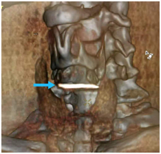 图源：深圳市第三人民医院