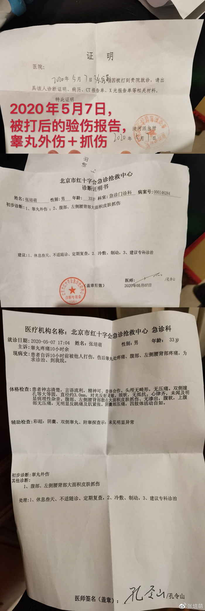  一直羞于出示的医院验伤报告