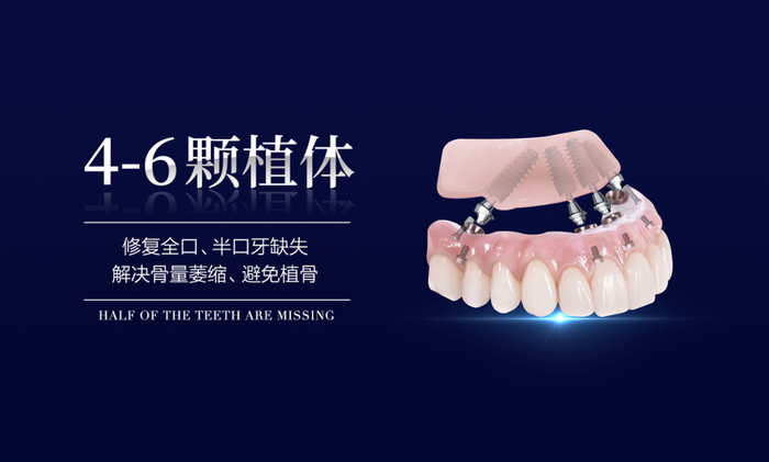 数字化半口/全口种植牙示意图