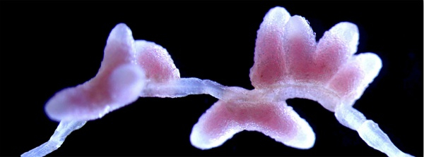 图说：苜蓿根瘤器官