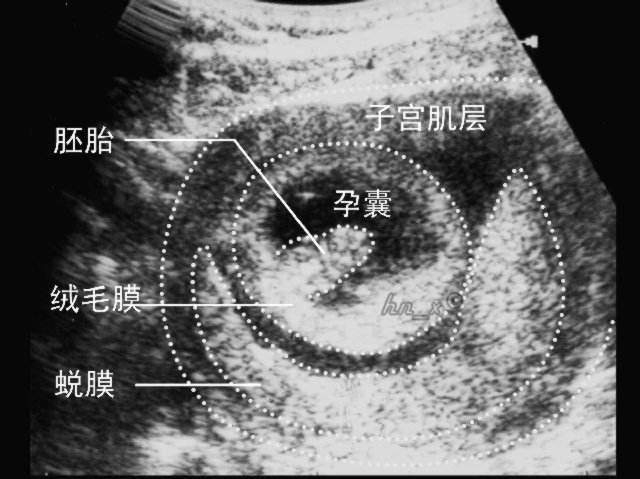 排卵期同房后,多久可以怀上宝宝?怀孕过程及孕早期注意提前了解