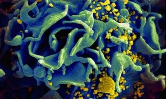 受HIV感染的T细胞 图片来源：NIAID