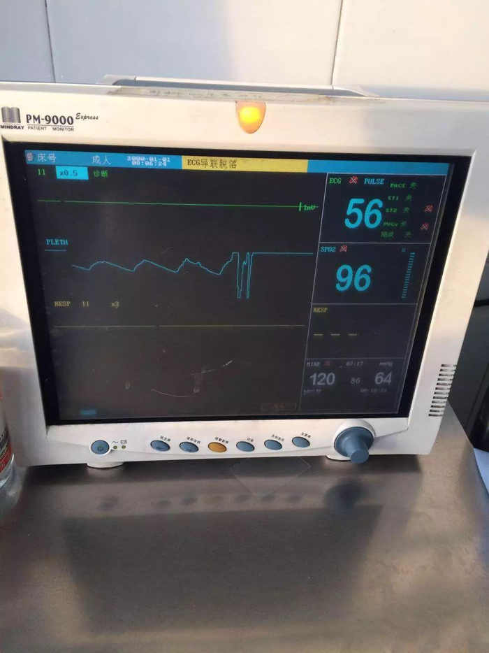 为什么要心电监护仪心电监护仪的8大操作要点,护理人员需掌握!_新闻资讯_第3张_活检穿刺产品网 为什么要心电监护仪心电监护仪的8大操作要点,护理人员需掌握!_https://www.jmylbn.com_新闻资讯_第3张