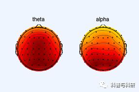 重磅预告：坐标深圳的一系列磁共振和脑电数据处理学习（2021年）插图28