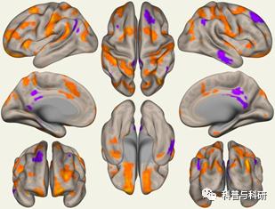 重磅预告：坐标深圳的一系列磁共振和脑电数据处理学习（2021年）插图14