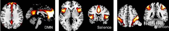 重磅预告：坐标深圳的一系列磁共振和脑电数据处理学习（2021年）插图18