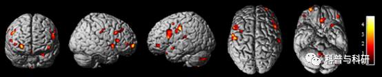 重磅预告：坐标深圳的一系列磁共振和脑电数据处理学习（2021年）插图2
