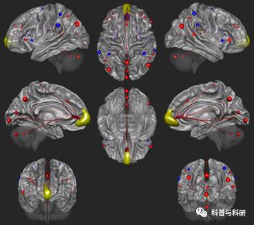 重磅预告：坐标深圳的一系列磁共振和脑电数据处理学习（2021年）插图17