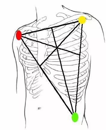 为什么要心电监护仪心电监护仪的8大操作要点，护理人员需掌握！_https://www.jmylbn.com_新闻资讯_第1张