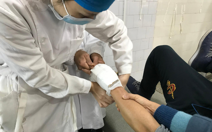 11月28日，社港医院手法正骨室，医护在为掌骨骨折患者包扎。新京报记者 张惠兰 摄