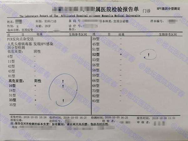 30岁女性一直无症状，孕前体检突然查出“宫颈癌前病变”