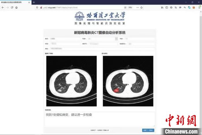 图为系统截图。　哈工大提供 摄