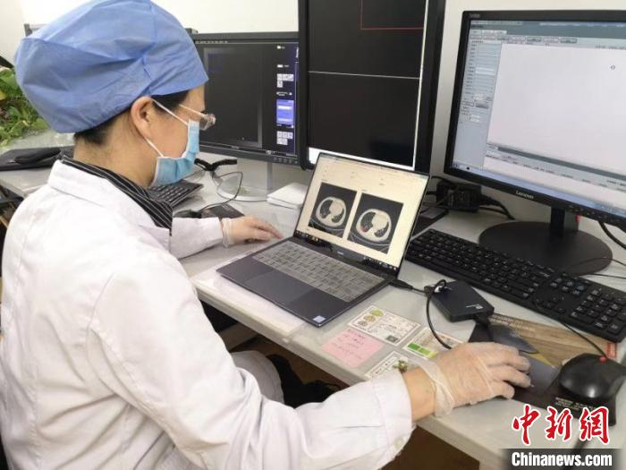     图为医务人员在操作系统。　哈工大提供　摄