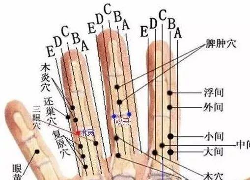 董氏奇穴-经典68穴（收藏起来）