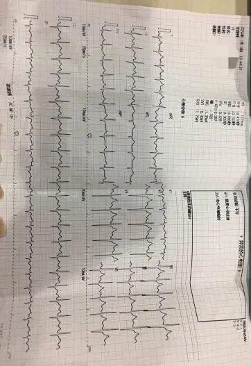 看美团如何谋财害命：骑手私售处方药、漫天加价、伪造票据