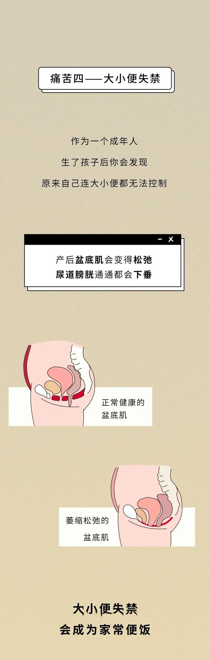 一张图告诉你生完孩子后还有多少痛苦，没人能笑着看完……