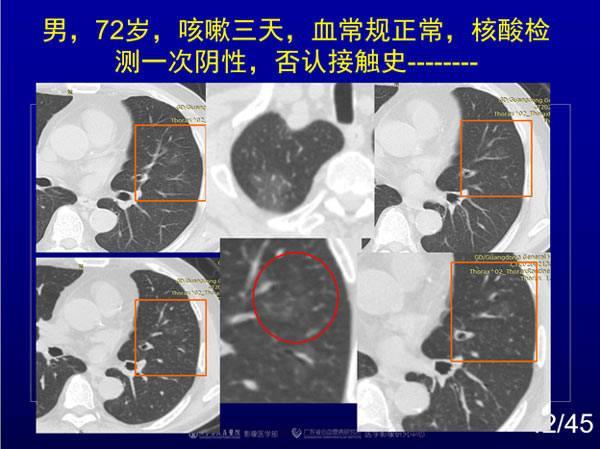 新冠病毒到底从哪来？我梳理了一大堆证据