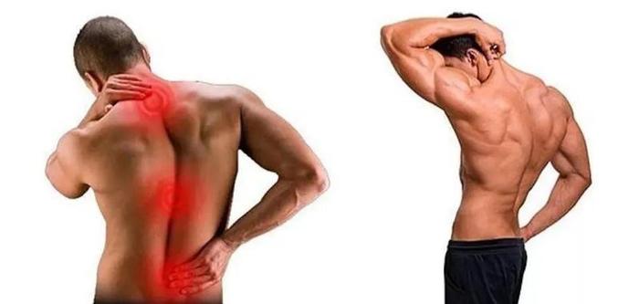 经常腰痛腰肌劳损，是不是肾虚？