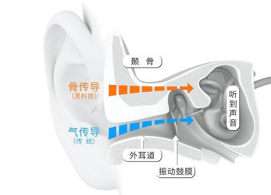 求同款！粉丝种草冰糖炖雪梨配骨传导耳机