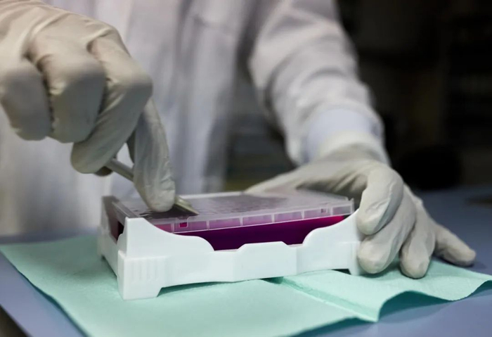 ■ 医护人员使用检测试剂。