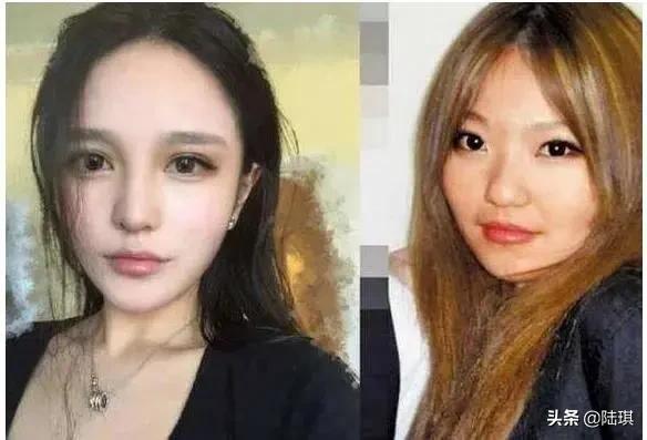 “该不该为了男人整容”：这两个女人的故事，给了截然相反的答案