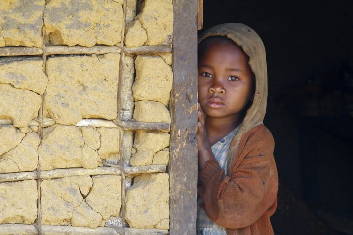 〓 非洲偏远地区儿童健康问题，触目惊心。/图虫创意