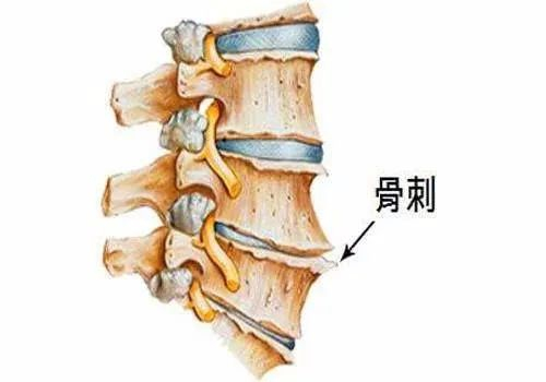 一个无比强大但快要失传的方子，上治颈椎，中治腰椎，下治膝盖