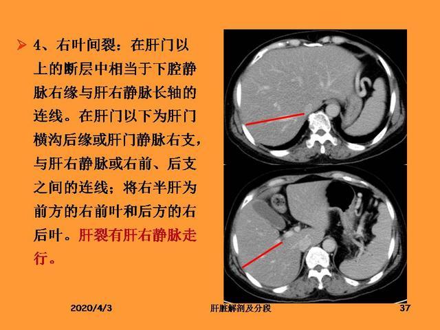 肝脏的解剖和分段