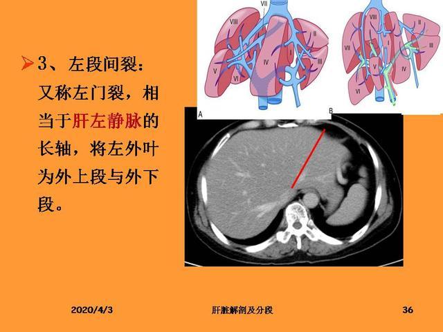 肝脏的解剖和分段