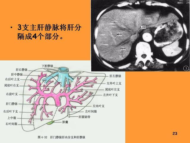 肝脏的解剖和分段