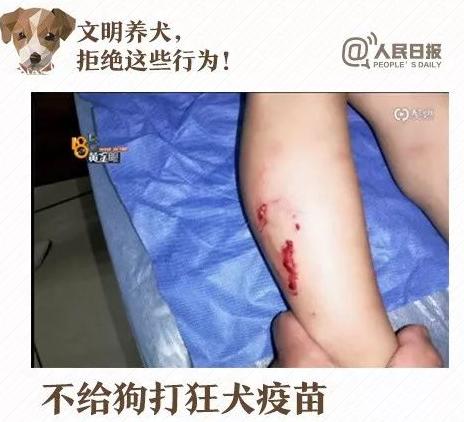 触目惊心！广西5岁男童被恶犬撕咬6分钟，伤口从眉角裂到后脑勺..