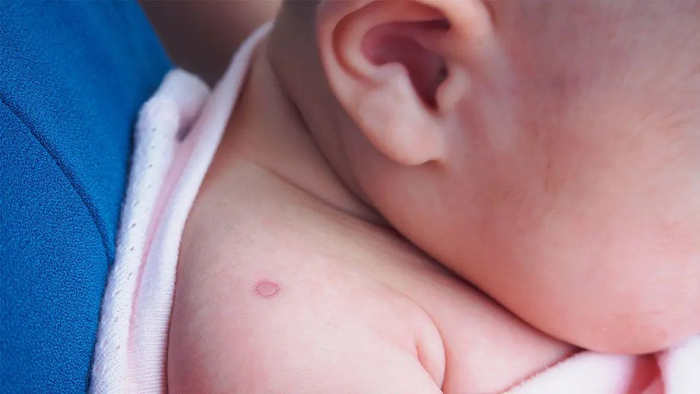  ↑至少4国正在测试卡介苗对抗新冠病毒的有效性 图据《纽约时报》