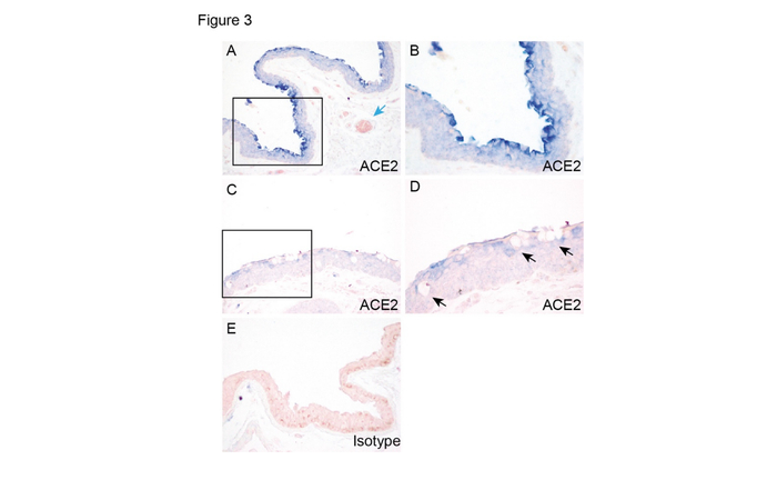  图2：死后眼球结膜的ACE2表达及定位。A-B，C-D来自2个眼球，E为正常IgG对照组。箭头表示血管内皮细胞（A）和杯状细胞（D）。