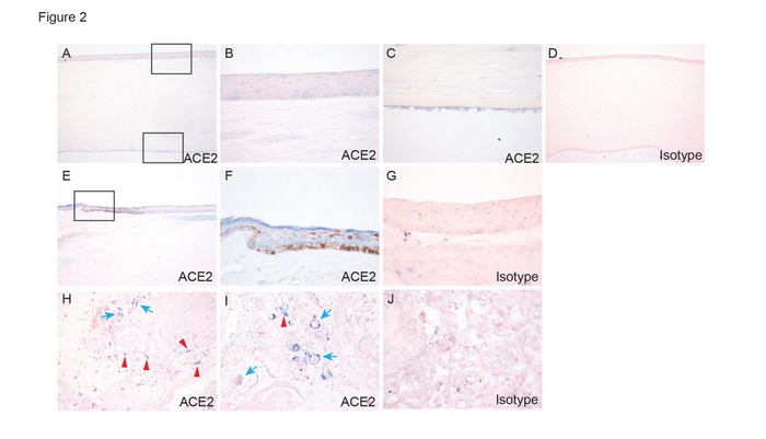  图1：ACE2在人角膜和角膜缘的表达和定位。图中展示了角膜（A-C）、角膜缘（E-F）和肺（H-I）的ACE2表达。D、G、J为对照组。（A）框中的区域在（B，C）中以较高的放大倍数显示。（E）框中的区域在（F）中以较高的放大倍数显示。肺上皮和血管内皮分别用红色和蓝色箭头表示。