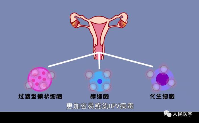 300多块预防一种癌症？张文宏力荐女孩子们在不懂事儿的时候早打宫颈癌疫苗