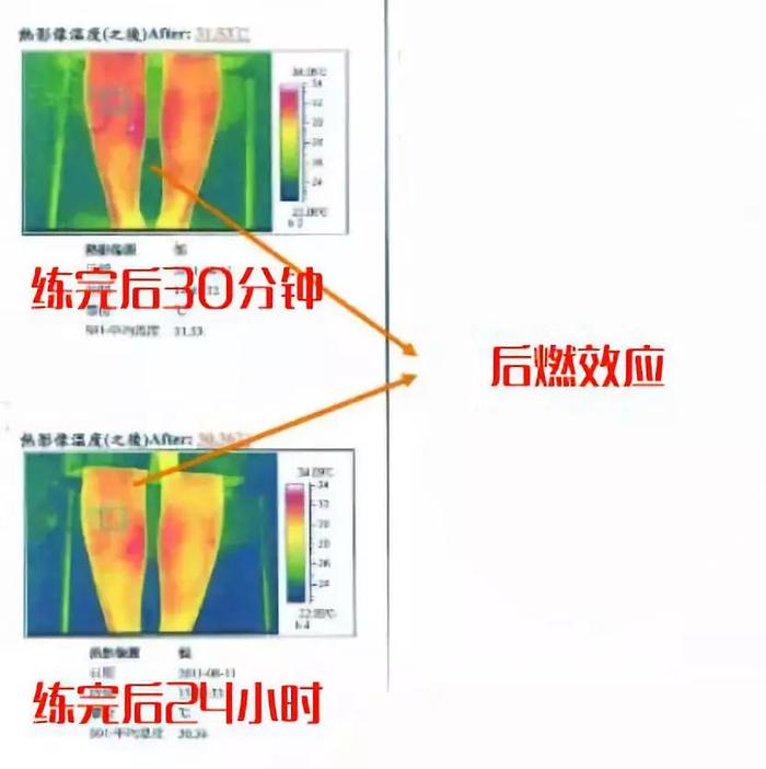 “小腿粗”毁了多少女生？每天15分钟，我的小粗腿消失了......