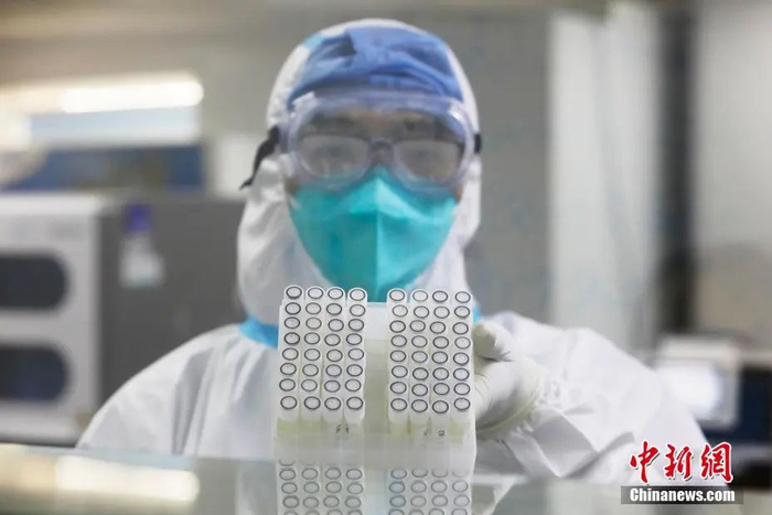 资料图：上海兰卫医学检验所工作人员展示样本。殷立勤 摄